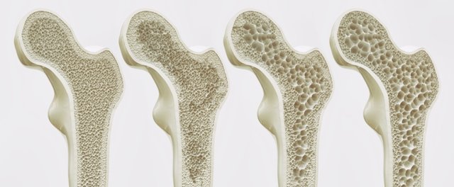 diagnostika-osteoporoza.jpg