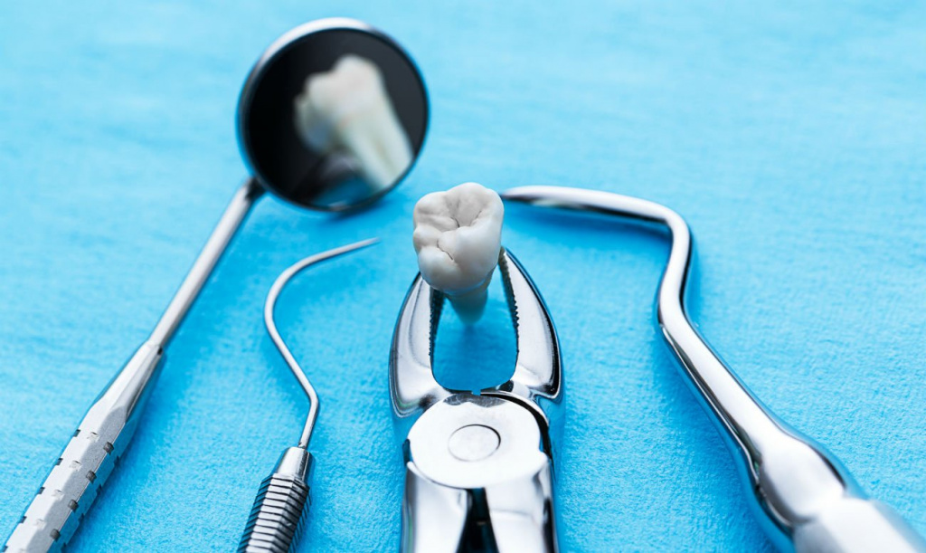 udalenie-zubov-v-chelyabinske.jpg