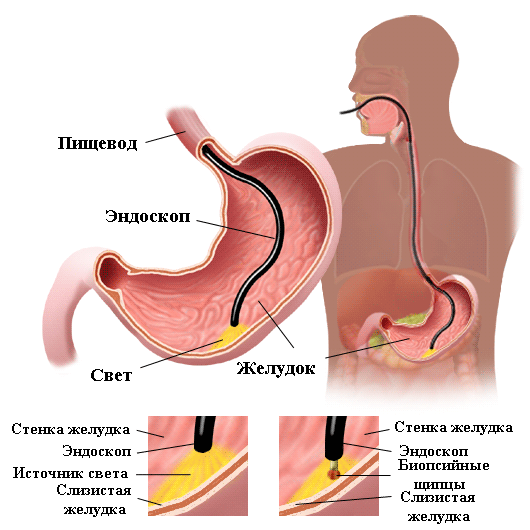 fgds-v-chelyabinske.gif